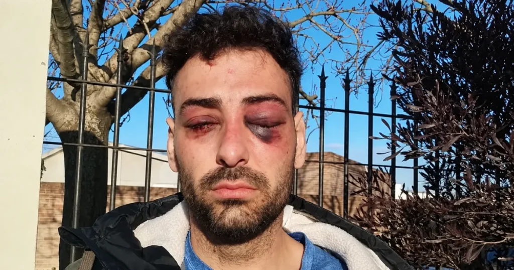 Un profesor de música de La Plata denunció una golpiza y torturas de la Policía: “Pensé que me mataban”