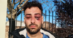 Un profesor de música de La Plata denunció una golpiza y torturas de la Policía: “Pensé que me mataban”